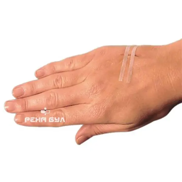 Omnistrip® – Sterile Wound Closure Strips — Hartmann, image 2