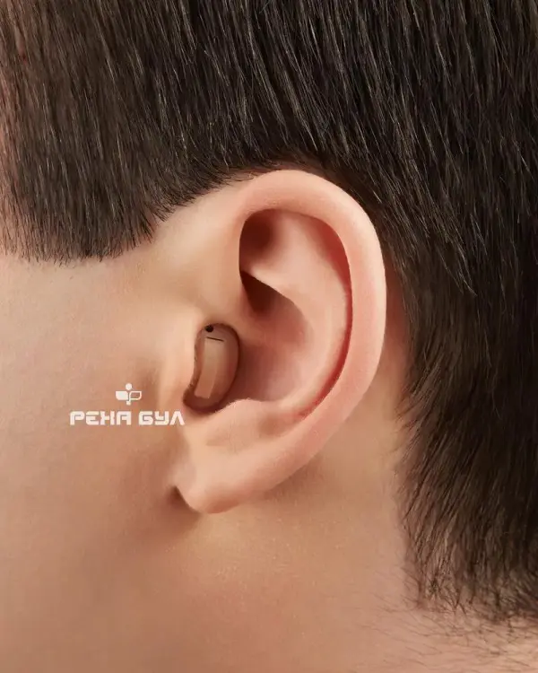 Siemens Intuis 2 Hearing Aid, image 2