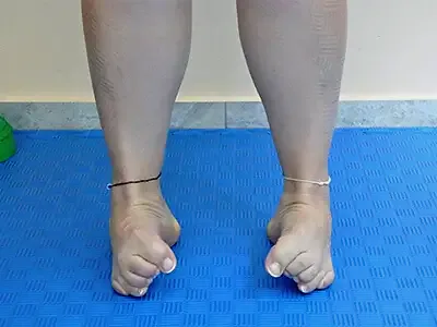 A woman stands on the outer edges of her feet with her toes curled in a grip